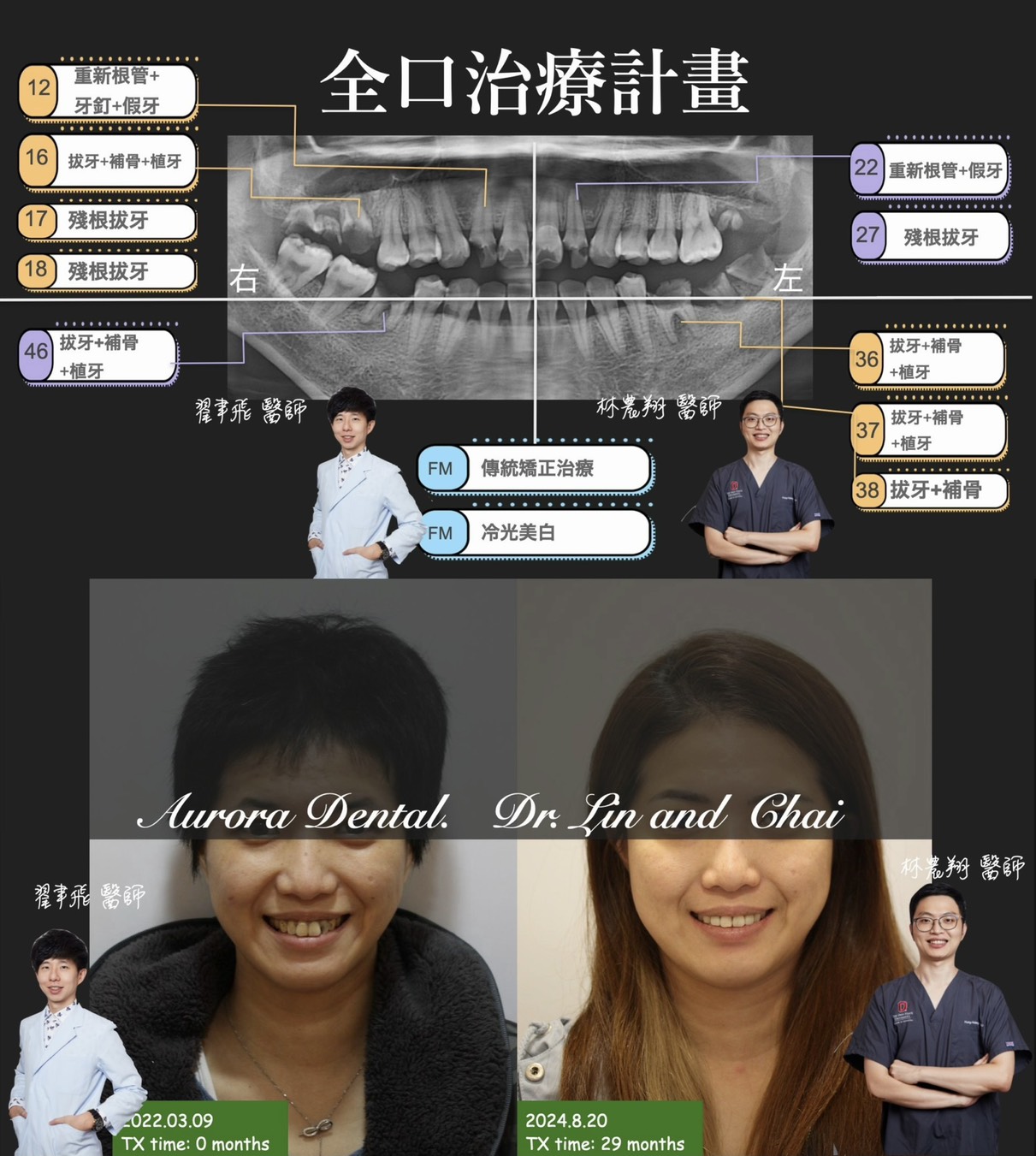 全口治療計劃